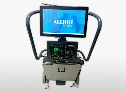 Alerio Mobile X-Ray